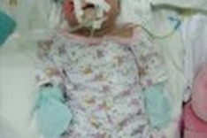 Readers give young girl twist of fate