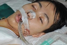 Young man on the verge of death after high fever