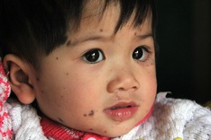 Parents call for help for their daughter