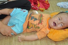 Baby struggles with hydrocephalus