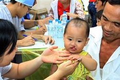 Additional 300 children recieve free smile surgeries