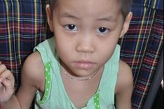 Little girl begs to keep her leg from being amputated