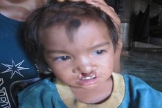 Ethnic J'Rai couple need help for disabled daughter