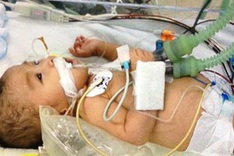 Little baby struggles with congenital heart disease
