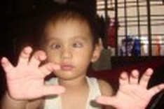 A life in darkness for twins