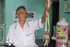 Vietnamese veteran regains amputated arm