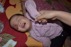 DTiNews readers support little girl struggling with retinoblastoma