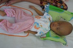 Little boy struggles with serious diseases