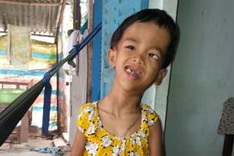 Strange illness deforms little girl's body