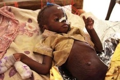 Global hunger down but progress slowing: UN