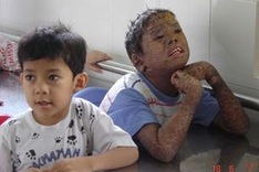 UK MPs raise funds for Vietnamese AO victims