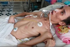 Young man with acute nerve inflammation in desperate fight for survival