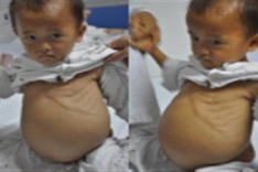 DTiNews readers support kidney cancer boy