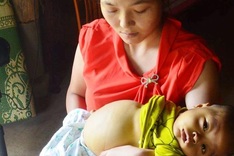 Little boy faces death risk due to serious diseases