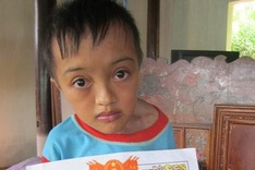 Brittle-bone boy faces life with strength