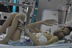 Ill teen lung transplant survivor calls for help