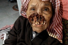 Elderly woman faces horrific rotting disease