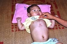 Poor couple powerless to save small son