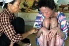 Photos by Agent Orange children on show in Paris