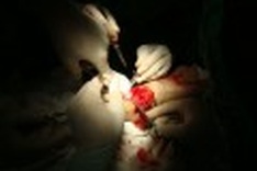 Aggressive fish attacking beach goers