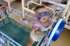 DTiNews readers help rescue maltreated orphans