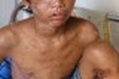 14 year old suffers unthinkable torture