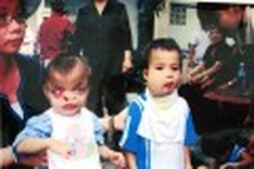 Photo exhibition marks 50 years of Agent Orange