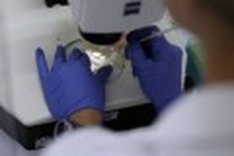US man is HIV-free after stem cell transplant