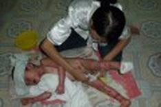 A little relief for boy living in a lot of pain