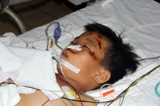 Cancer mother, seriously-injured son call for help