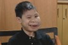 Vietnamese boy thanks Boston doctors for his smile