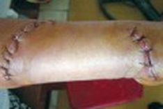 Suspected shark attacks three in central Vietnam