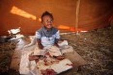 Diseases on the rise, amputees long-term challenge for Haitian gov't