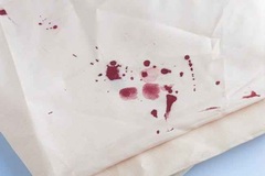 Chảy máu vùng kín khi quan hệ, cô gái chẳng ngờ mình mắc ung thư cổ tử cung