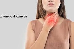 5 dấu hiệu không ngờ cảnh báo ung thư thanh quản