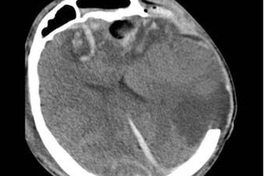 Russian mother and son with brain injuries saved in Vietnam