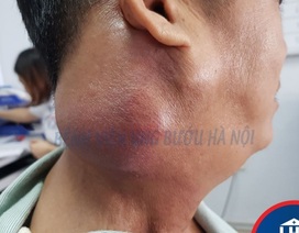 Người đàn ông bàng hoàng khi biết mắc cả 2 bệnh ung thư giai đoạn cuối