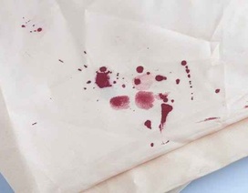 Chảy máu vùng kín khi quan hệ, cô gái chẳng ngờ mình mắc ung thư cổ tử cung