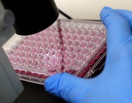 Phát hiện nguyên nhân gây ung thư di căn