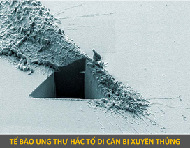 Vẻ ma mị của những tế bào ung thư đạt giải trong cuộc thi nhiếp ảnh