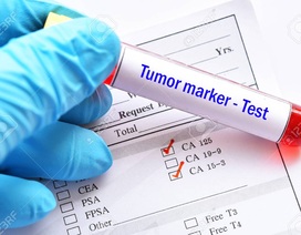 7 dấu ấn ung thư thường sử dụng