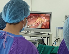 Nội soi cắt u gan cho bệnh nhân ung thư gan