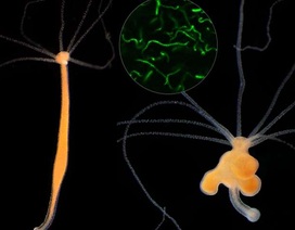 Liệu hệ vi sinh khỏe mạnh có tiềm ẩn nguyên nhân gây ung thư?