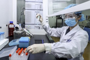 Hé lộ bảng giá vắc xin Covid-19 toàn thế giới