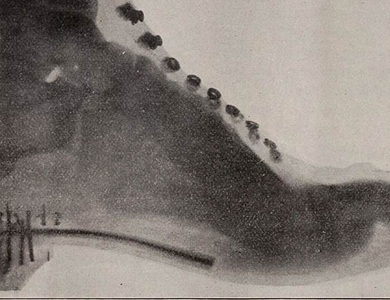 Đo cỡ giày bằng máy chụp X-quang từng là xu hướng thời thượng vì sức khỏe