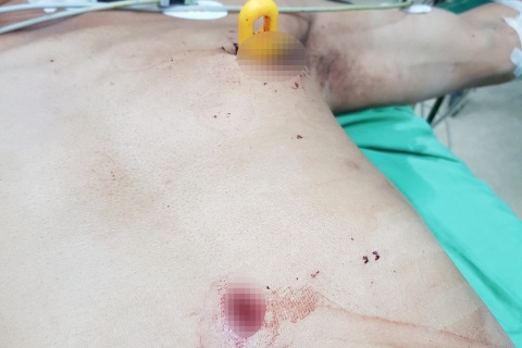 Bệnh viện gác thủ tục hành chính, tập trung cứu sống bệnh nhân nguy kịch