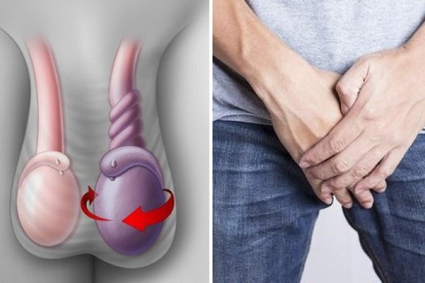 Tai nạn xảy ra trong lúc ngủ có thể khiến quý ông mất đạn