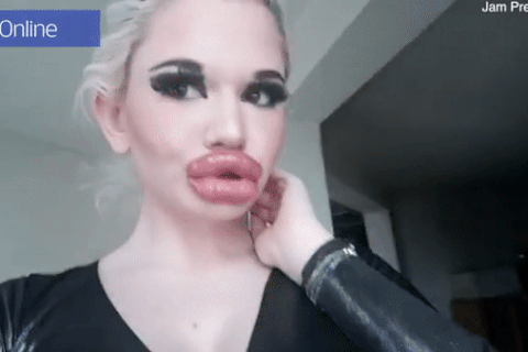 Cô gái bơm môi lần thứ 27 vì muốn trông giống... búp bê