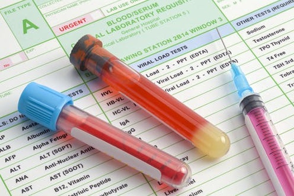 xét nghiệm máu phát hiện ung thư tiền liệt tuyến | Báo Dân trí
