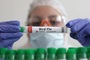 Cambodia reports child infected with H5N1 avian influenza